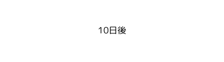 10日後